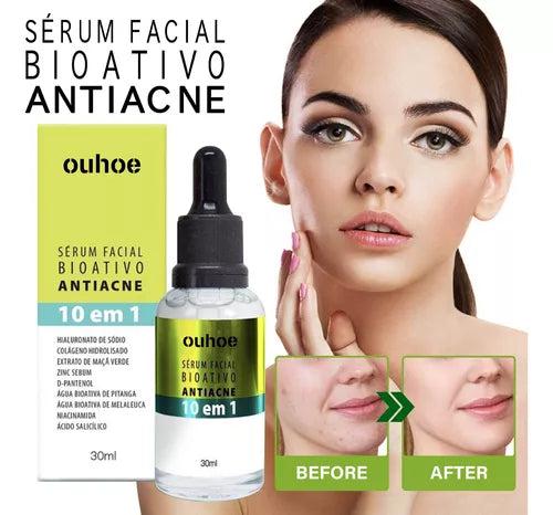 Sérum Facial Bioativo Antiacne 10 em 1 Max Love